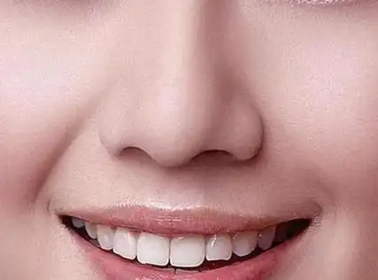 如何通过鼻综合手术得到好看的鼻子?功效怎样?本文带你了解一下