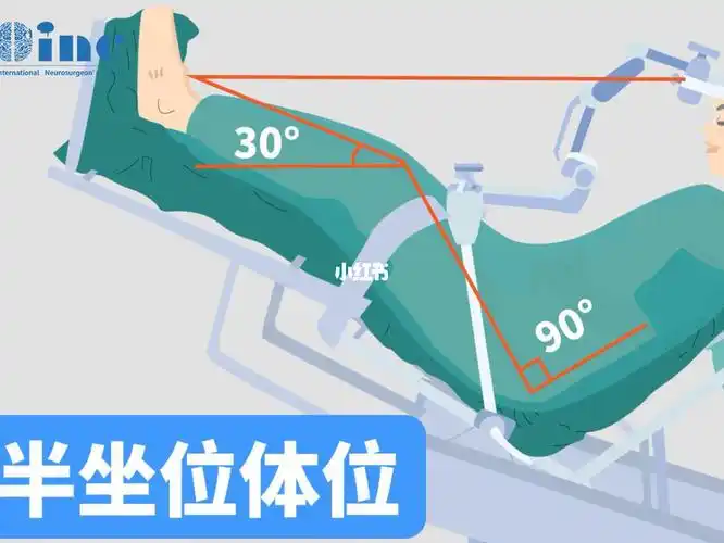 脑瘤手术可以坐着一起来看看半坐位的优势