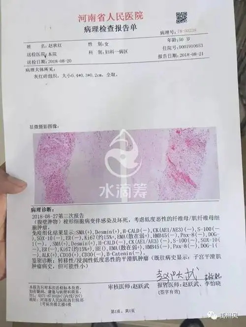 河南许昌:禹州市人民医院子宫肌瘤手术失误隐瞒病情