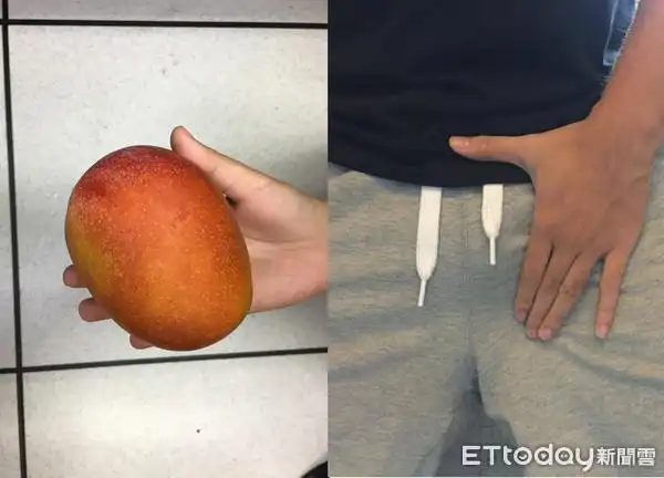 於是他也跟著长居对岸,近日因右侧阴囊日益肿大,仅管天气炎热在家也都