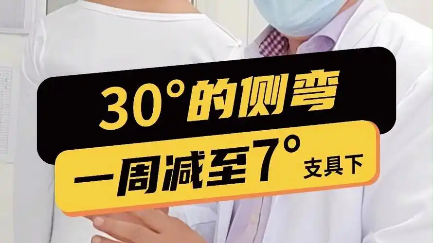 30度的脊柱侧弯一周减至7度谨慎选择治疗方法哦