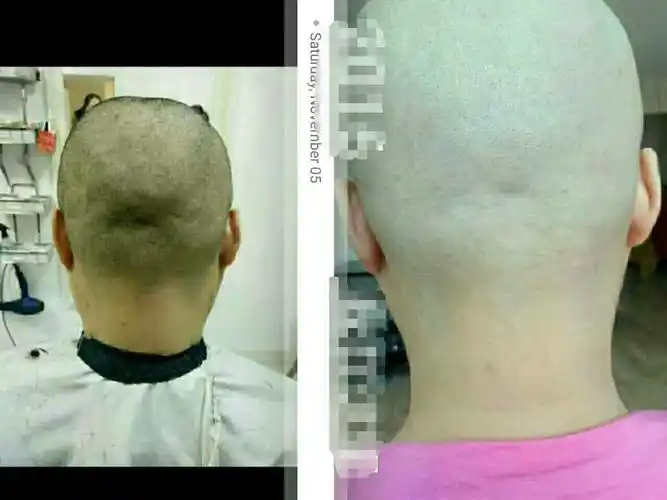 昨天当理发师给她理完发后看到她后脑勺凹凸不平吓了一跳!