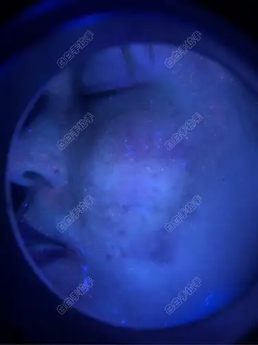 想让论坛朋友们帮忙给看看,伍德灯下的脸部是不是白白啊?