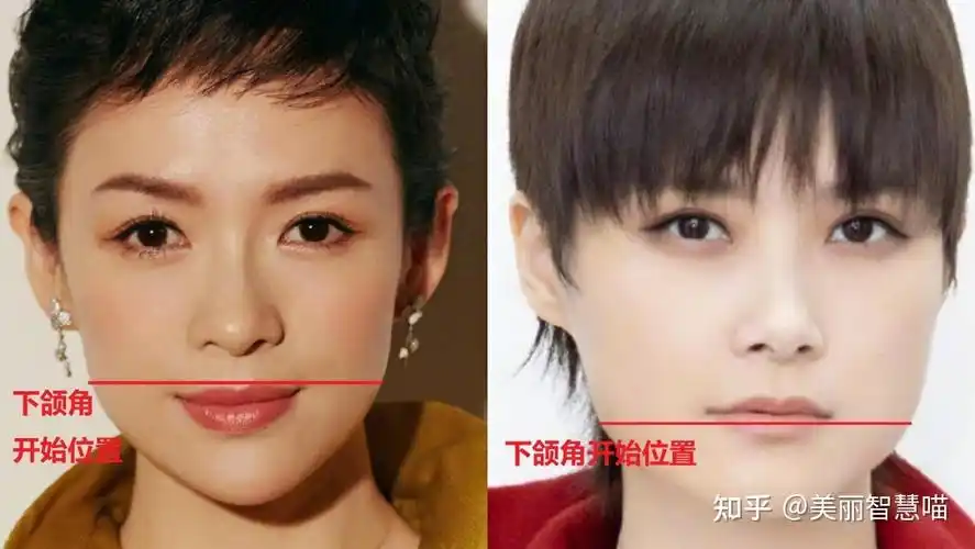 下颌角干货了解这些宽方脸也能又美又高级