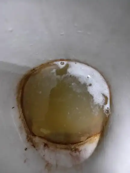 尿从晚上到今天会有白色的一层?