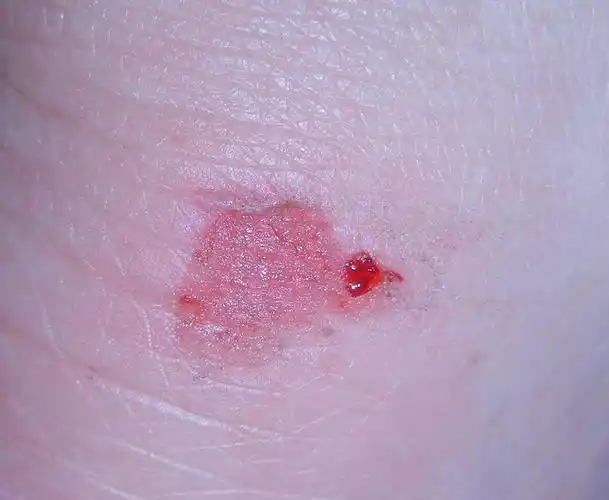 老姐新买的鞋把脚磨了!~~~~(>_ )