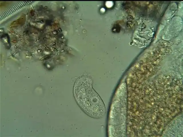 水产必备鱼类常见寄生虫大汇总一大波高清图谱奉上