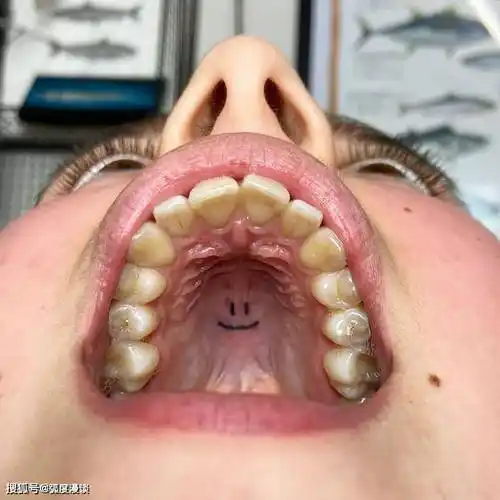 低调新潮流张嘴才看的见口腔内刺青比唇内刺青更难一眼看见