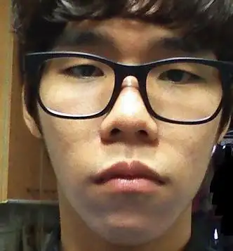 鼻子短,呈朝天鼻,或者是鼻孔外漏时,可以做鼻子延长手术通过鼻子延长