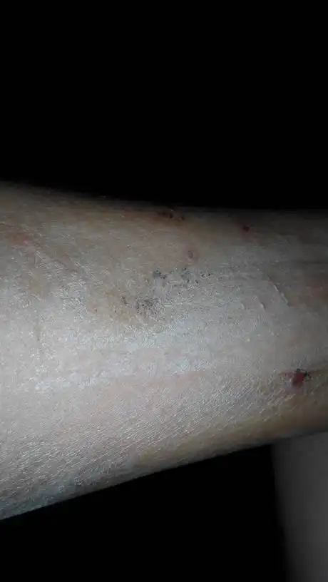 像这样的脚上皮肤有时很痒,该怎么办呢?