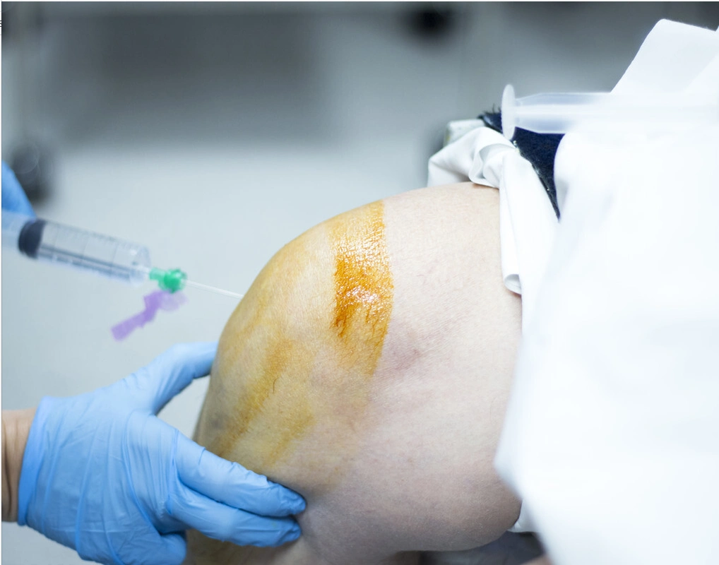 关节疼痛打针治疗能痊愈吗?