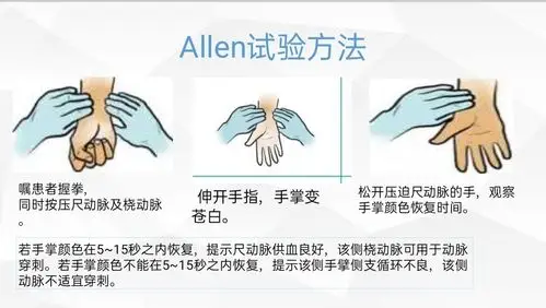 临渭区中医医院外科——第六十期业务学习(动脉采血临床指南) - 美篇