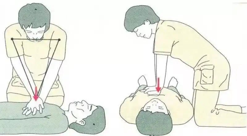 写美篇  第三步 进行胸外心脏按压