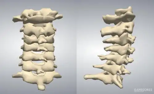 颈椎骨的冠状面,矢状面