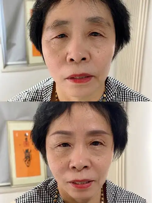 一高一低有点明显耶