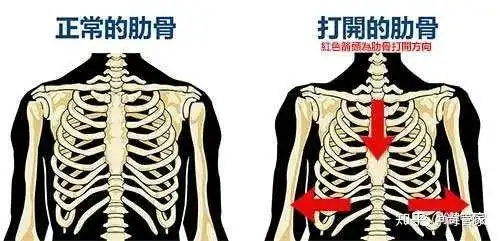 一文看懂"肋骨外翻"的所有概念