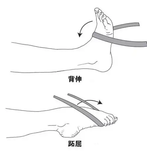 选择小弹力的弹力带开始,10个每组,背伸和跖屈各3-5组/日.