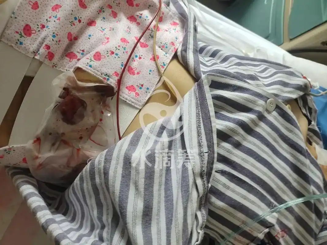 哥哥希望你今天经过了六七个小时手术后,以后希望你健健康康平平 - 抖