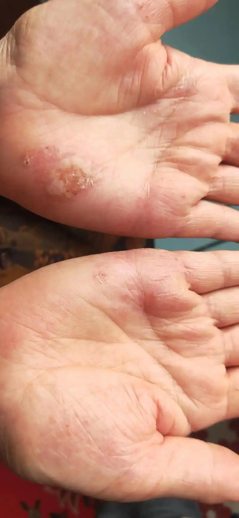 抖音里的亲们,有没有认识的治疗皮肤白病的好大夫,求推荐,万分 - 抖音