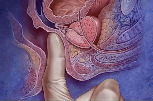 身体若发出这5个信号或要去做直肠指检别害羞