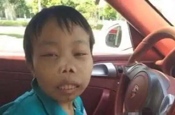 yy外星人陈山_yy外星人陈山被称最丑富二代,身份背景被扒