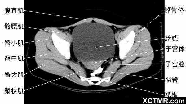 腹部盆腔ct断层 microsoft word 文档