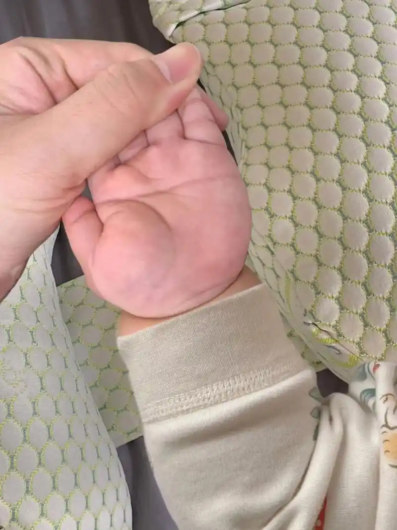 偶然间发现我宝宝的两只手居然是断掌,听别人说是唐氏.之前一直没注意