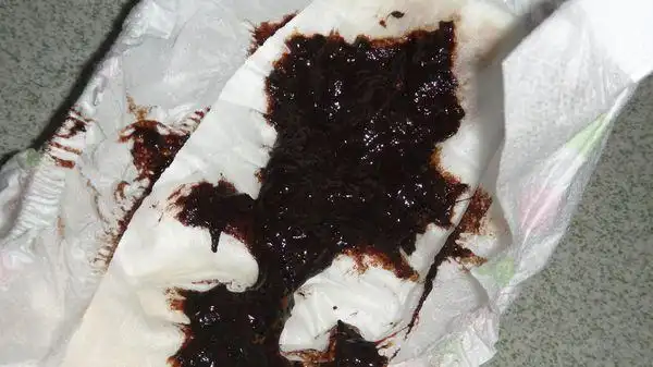 1个月 6天bb拉黑便,拉了3天了,一直便秘,都是