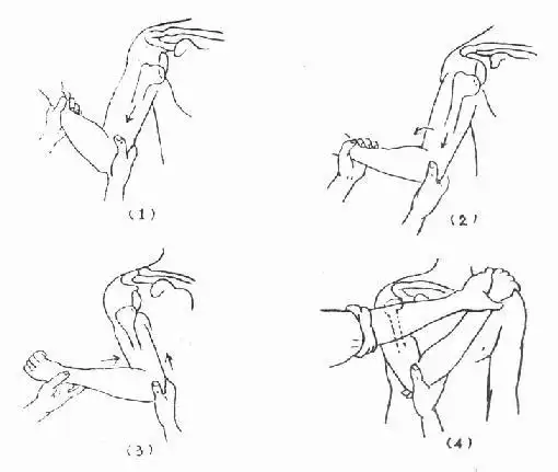 第二节 关节脱位