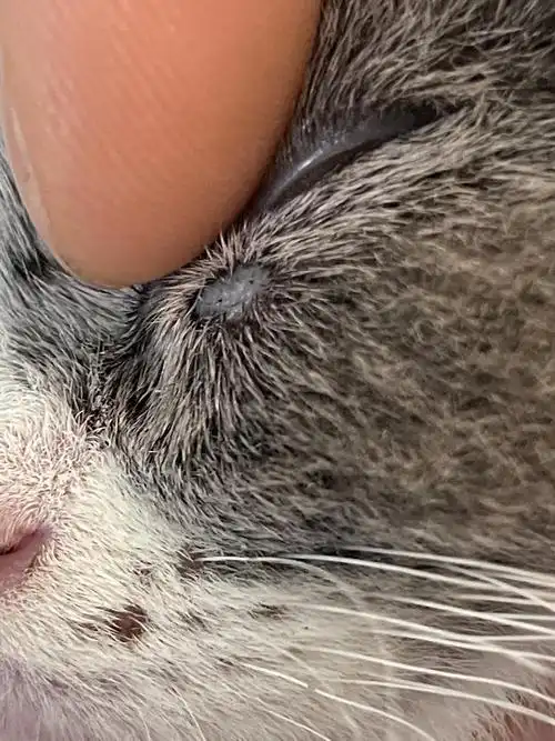 眼角下有白色的息肉 那个到底是什么啊