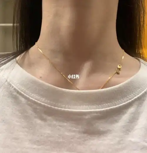 脖子向上仰 发现颈处有点不正常 这是甲状腺吗慌的不行