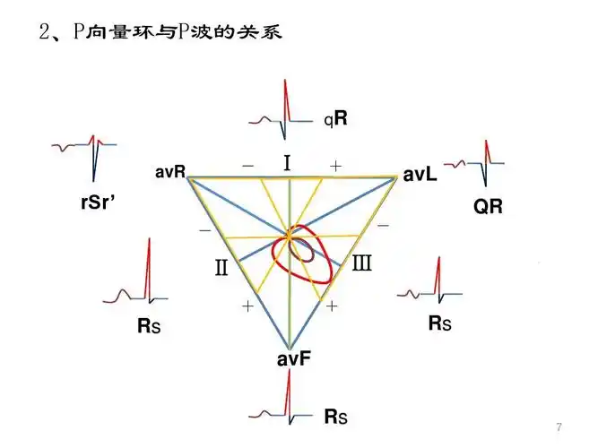 无忧文档 所有分类 高等教育 医学 心电图课件ppt 心电图 2,p向量环与