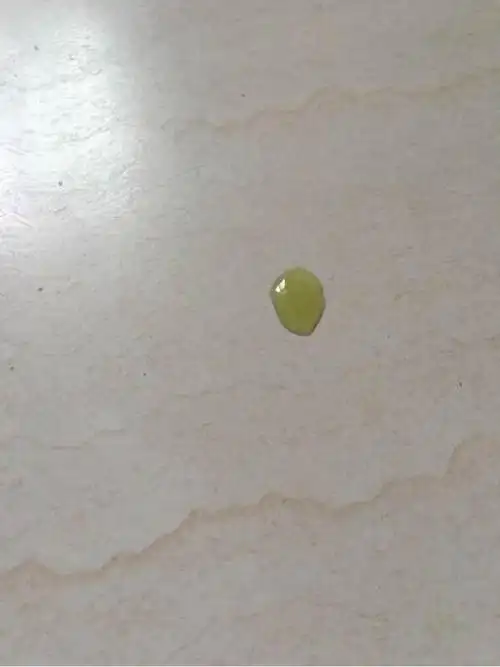 托的尿,早上拉的便便上还有油,拉的尿尿呈绿色~幸运的是昨天晚上开始