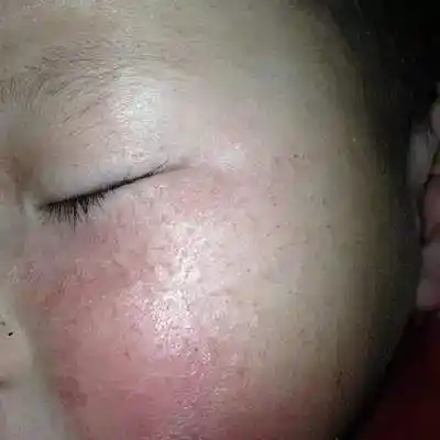 干燥皴裂怎么办,教你几招,还宝宝娇嫩肌肤|宝宝|皴裂|皮肤_新浪新闻