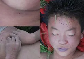 被杀害的小男孩尸检图_小男孩尸检_小男孩睾