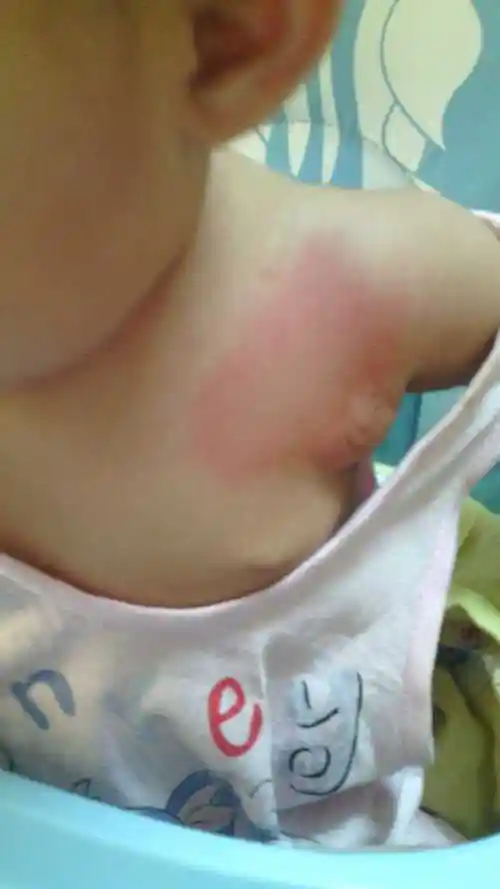 皮肤怎么回事儿?