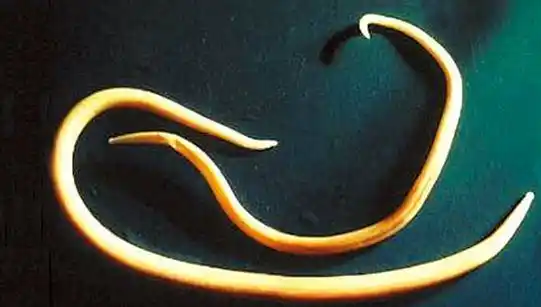 肚子里有蛔虫的症状图片