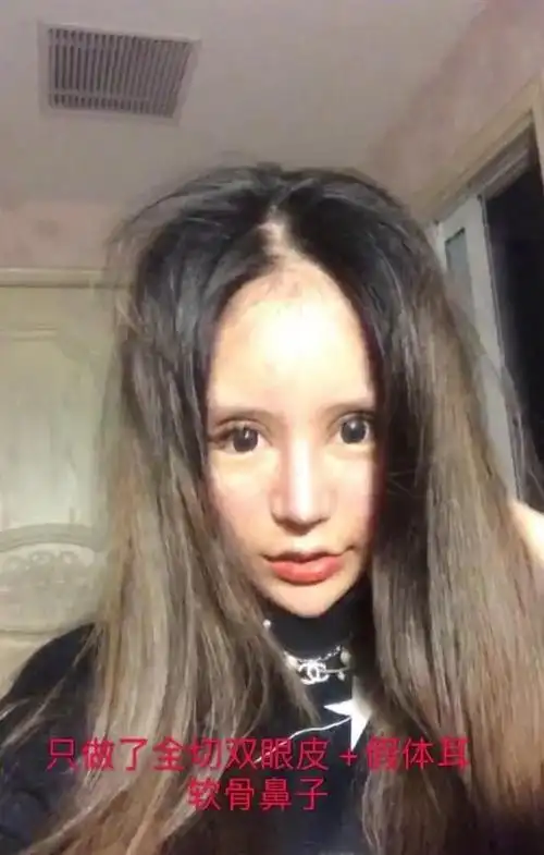 16岁网红小z娜娜3年整容超60次突破人类极限只为变真人芭比