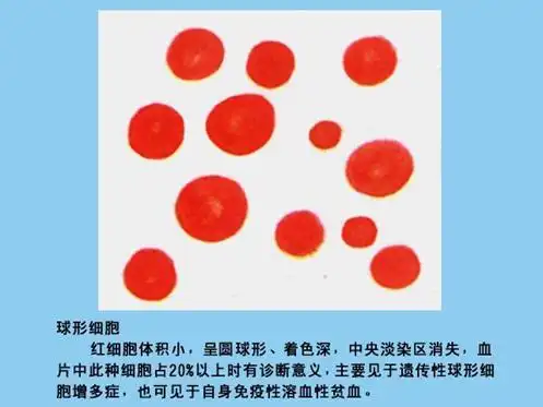 检验主管技师辅导红细胞形态异常1