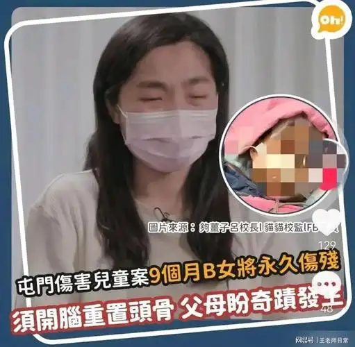 一名9个月大的女婴疑似遭到社区保姆的虐待,导致女婴脑部有血块和左眼