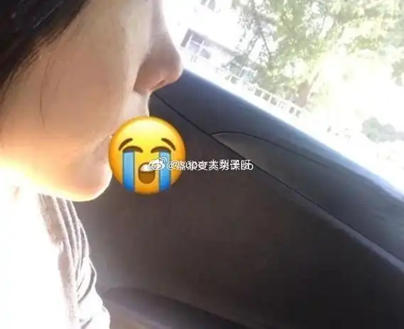 本来鼻子其实也不是特别的丑,做完了基本毁容98侧面朝天鼻,露鼻孔