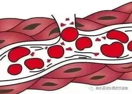 你了解血小板止血的工作过程吗?