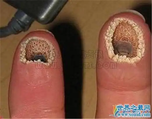 恐怖的密集恐惧症图片大全密集恐惧症患者千万别进