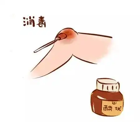 注意了,处理皮肤擦伤的三大误区!