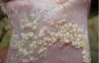 鸡白色念珠菌病的防治