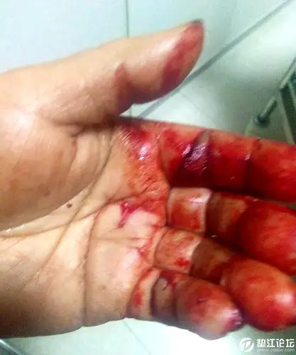 城管暴力执法,导致一弱女子受伤!