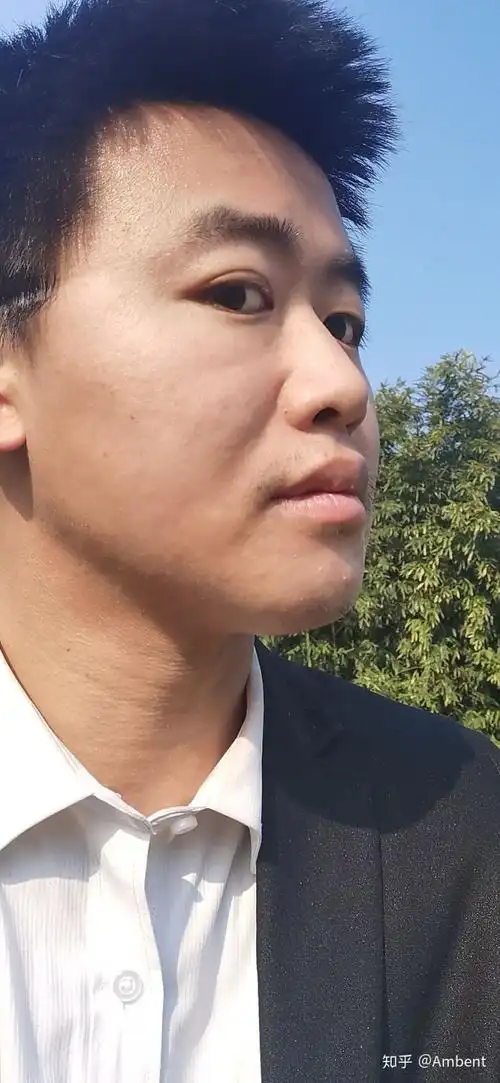 山根低陷_山根低陷易经补救方法_王健林山根低陷