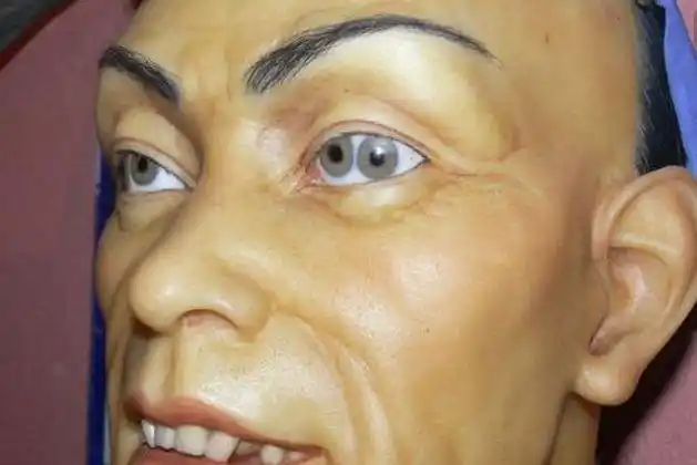 众所周知,人的瞳孔是只有一个的,可是在世界上却有两个甚至是多个瞳孔