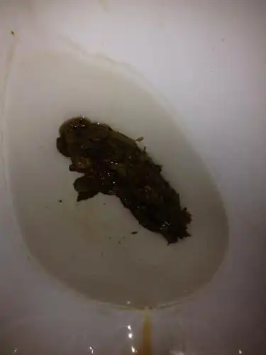 大便这个颜色放屁有点腐臭的感觉