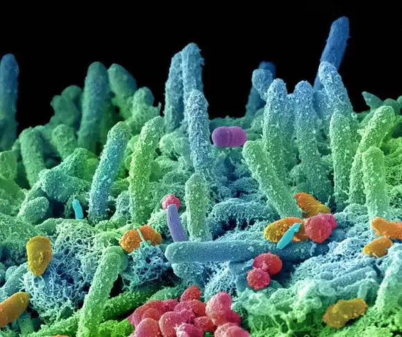 显微镜下的口腔细菌细长如海洋植物